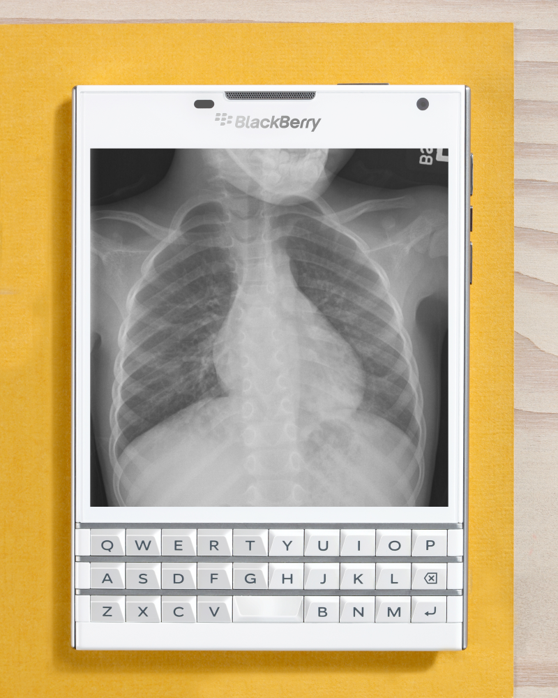 BlackBerry Passport, White Passport, X-Ray, Lungs, Medical Vertical, Claron Technology, BlackBerry App